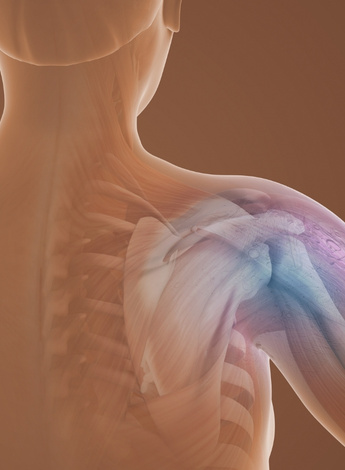 Graphic of frozen shoulder